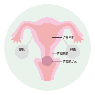 200036_03.gif 200036_03.gif